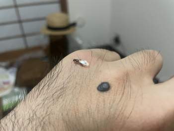 869681 B